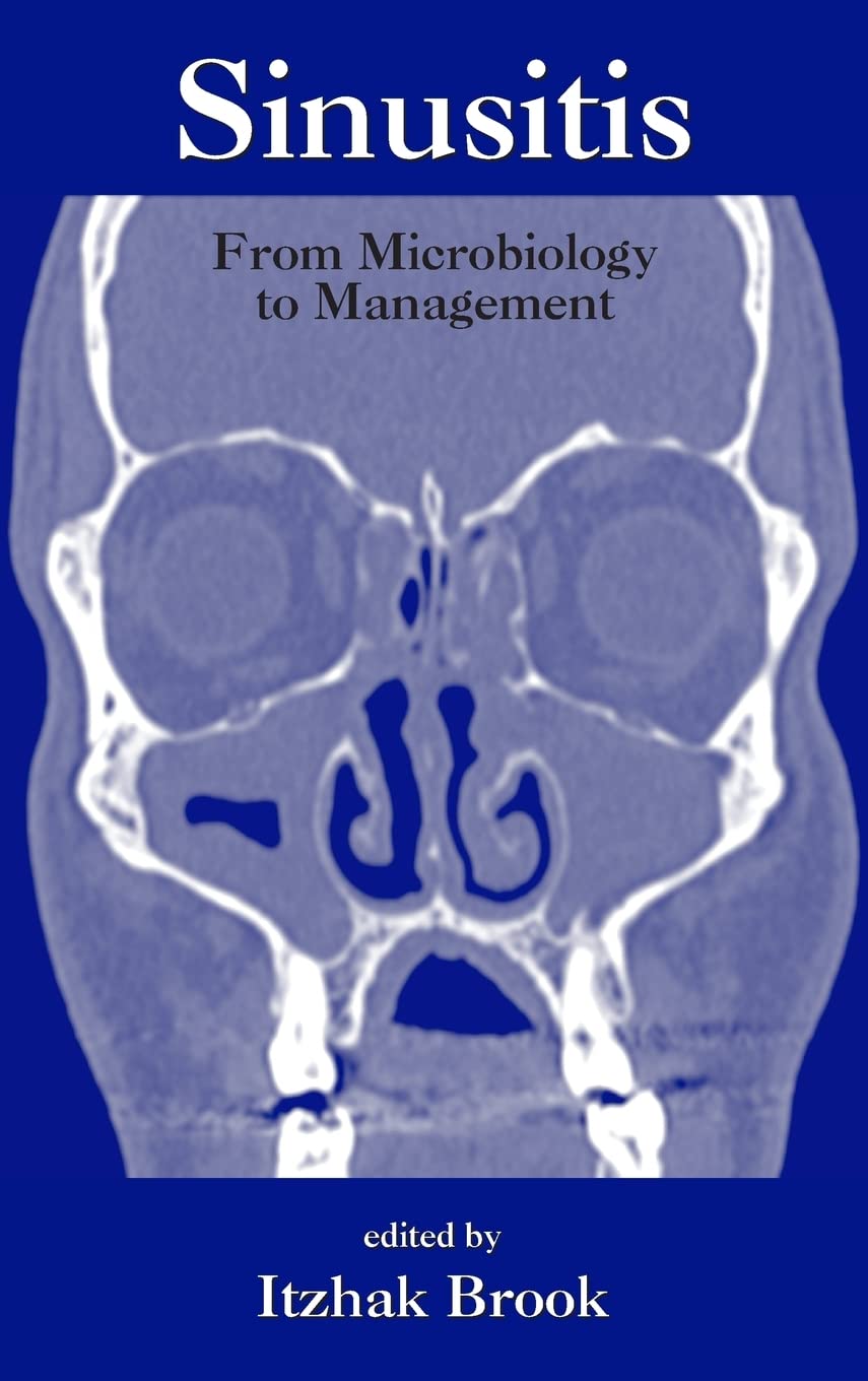 Sinusitis: Comprehensive Insights from Itzhak Brook's Expertise
