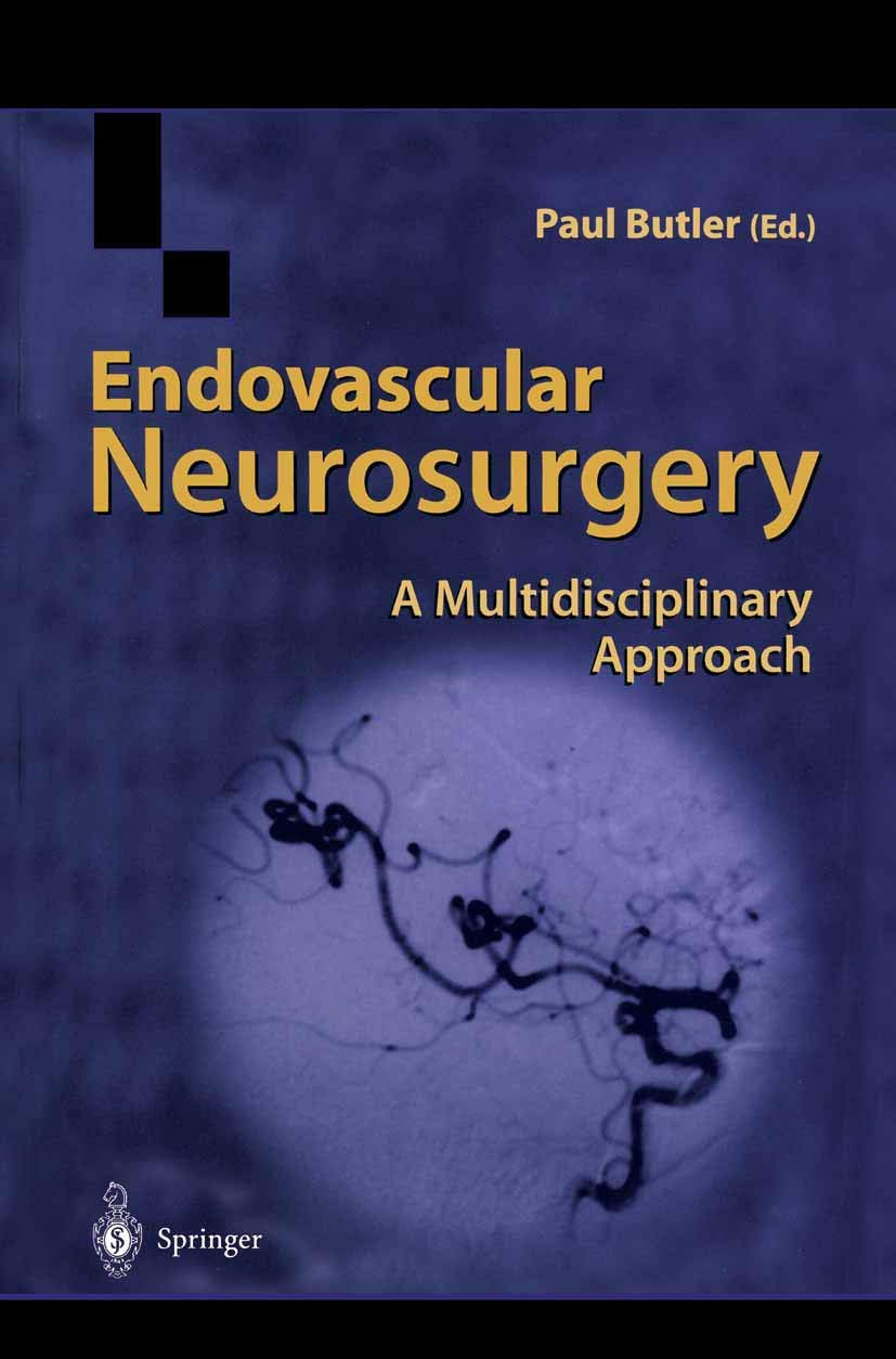 Endovascular Neurosurgery: A Multidisciplinary Approach Review