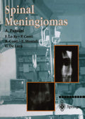 Spinal Meningiomas - Clinical Study and Surgical Pansini