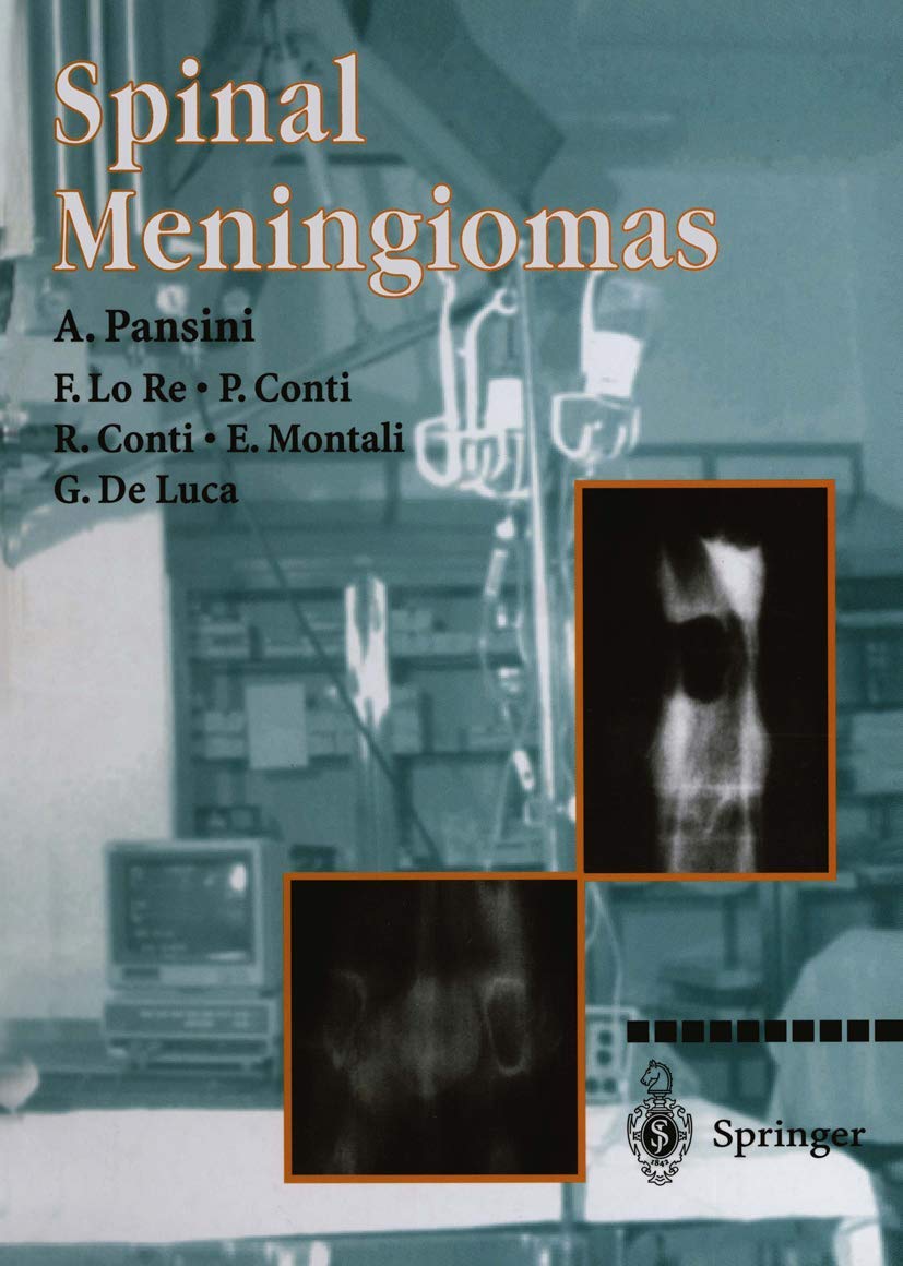 Spinal Meningiomas: Comprehensive Insights and Treatment Options