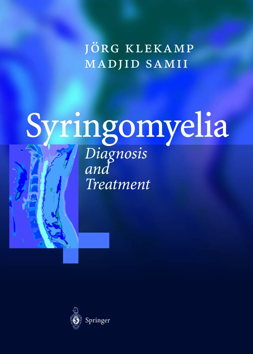 Syringomyelia: Diagnosis and Treatment Insights for Patients