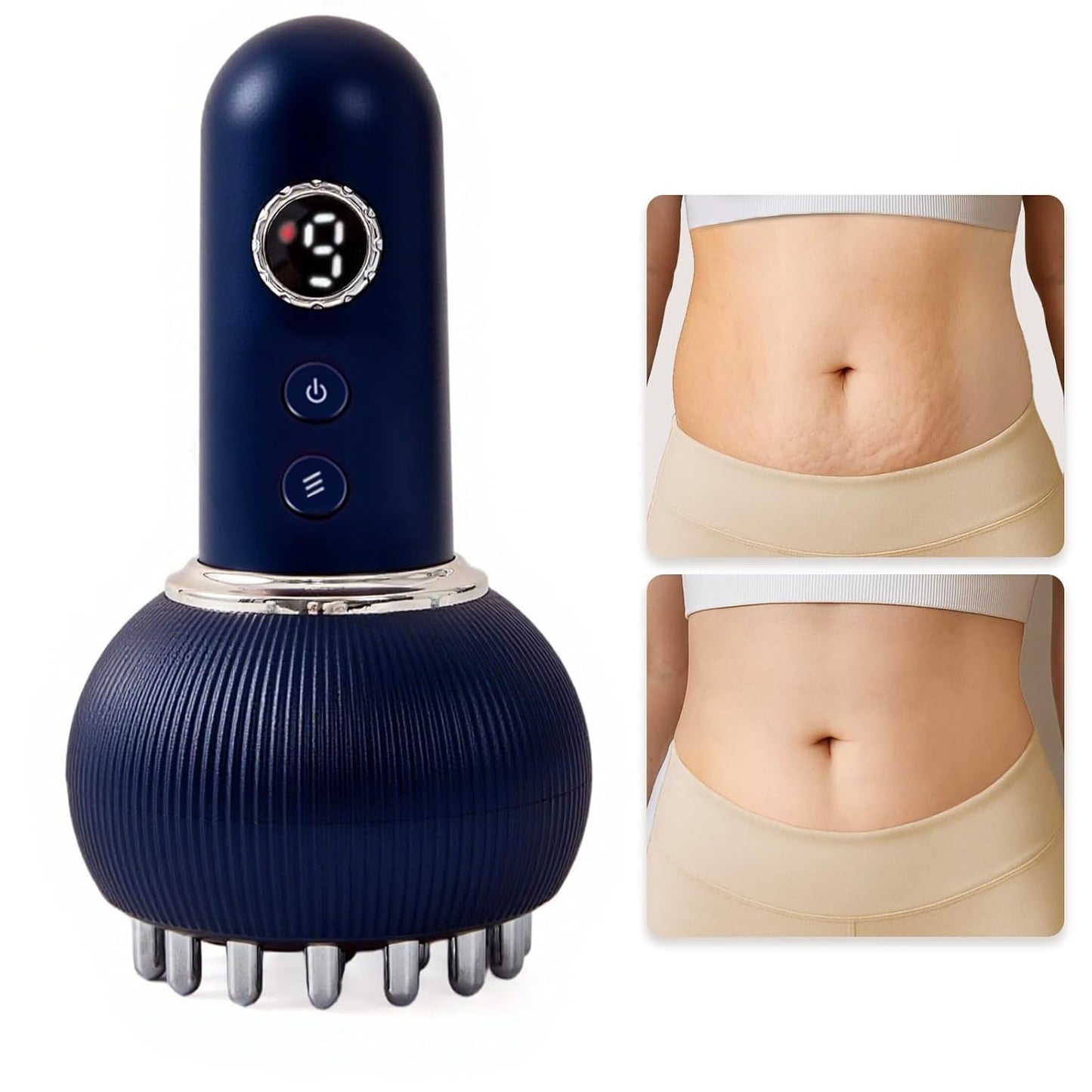 Lymphatic Drainage Massager for Cellulite Reduction & Sculpting