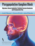 Pterygopalatine Ganglion Block: Practical for Headache Treatment