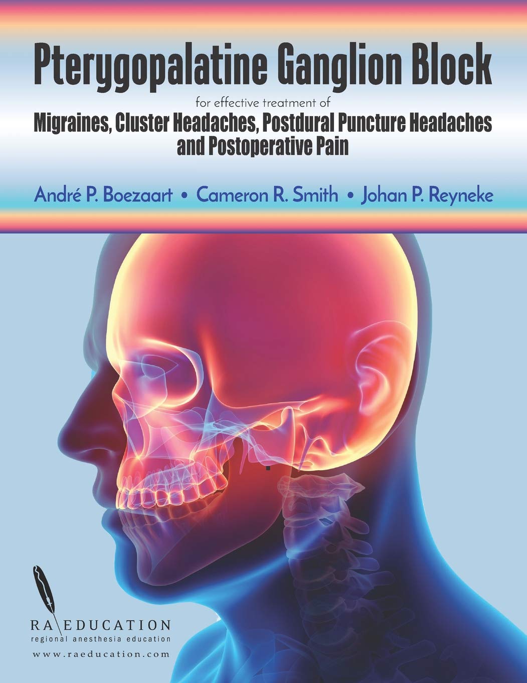 Pterygopalatine Ganglion Block for Effective Migraine Relief
