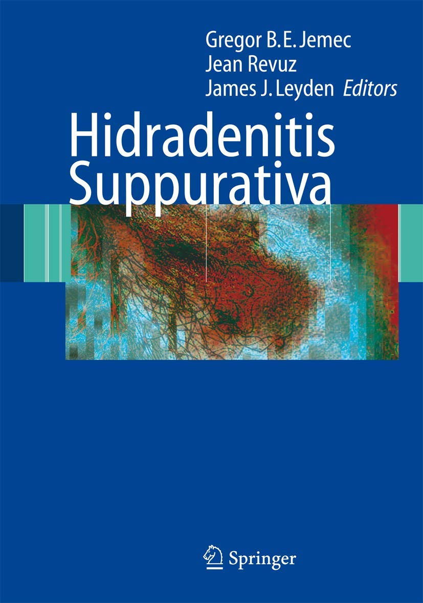 Hidradenitis Suppurativa Treatment for Skin Health and Comfort
