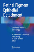 Retinal Pigment Epithelial Detachment: Differential Diagnosis