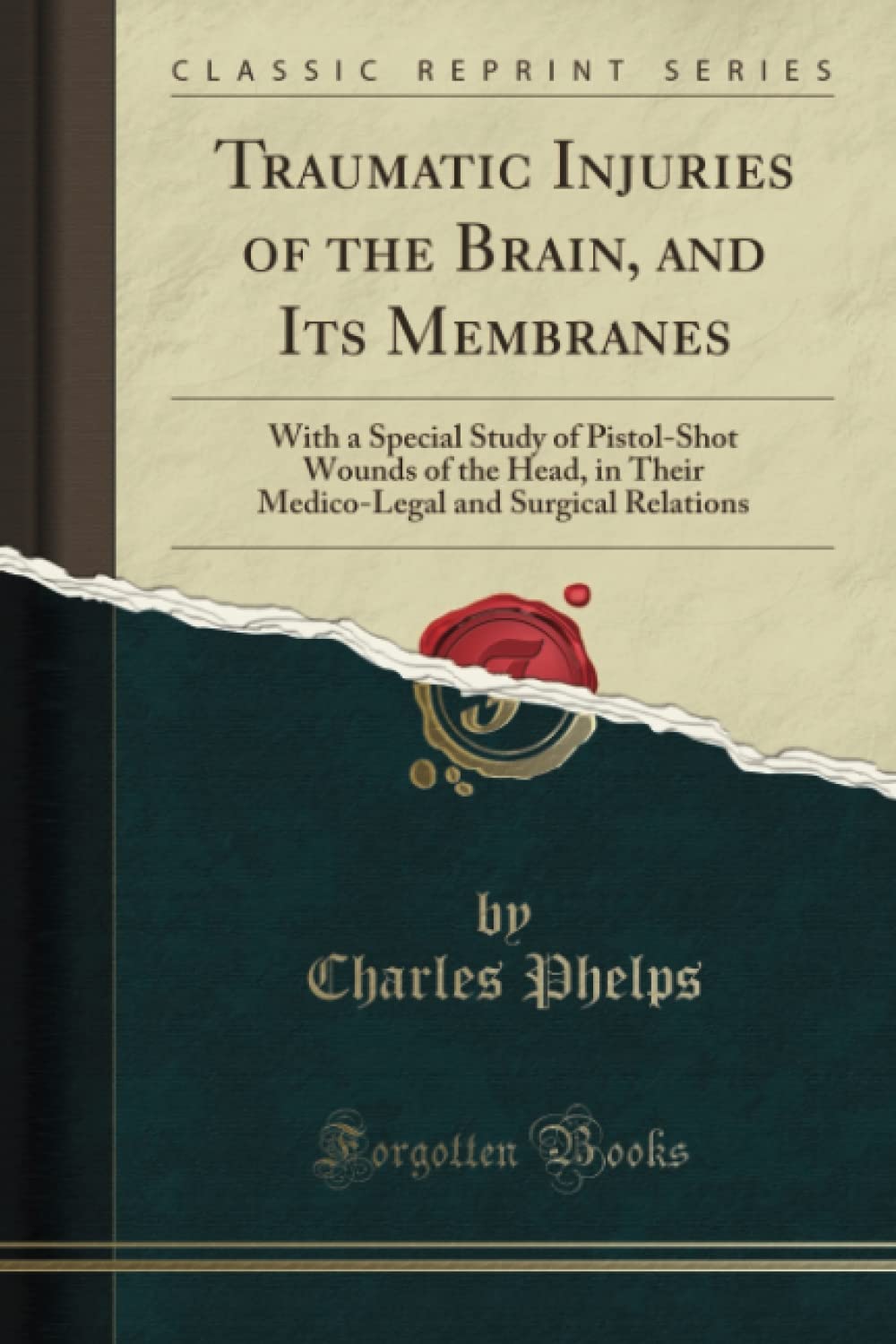Traumatic Injuries of the Brain: A Comprehensive Study Guide