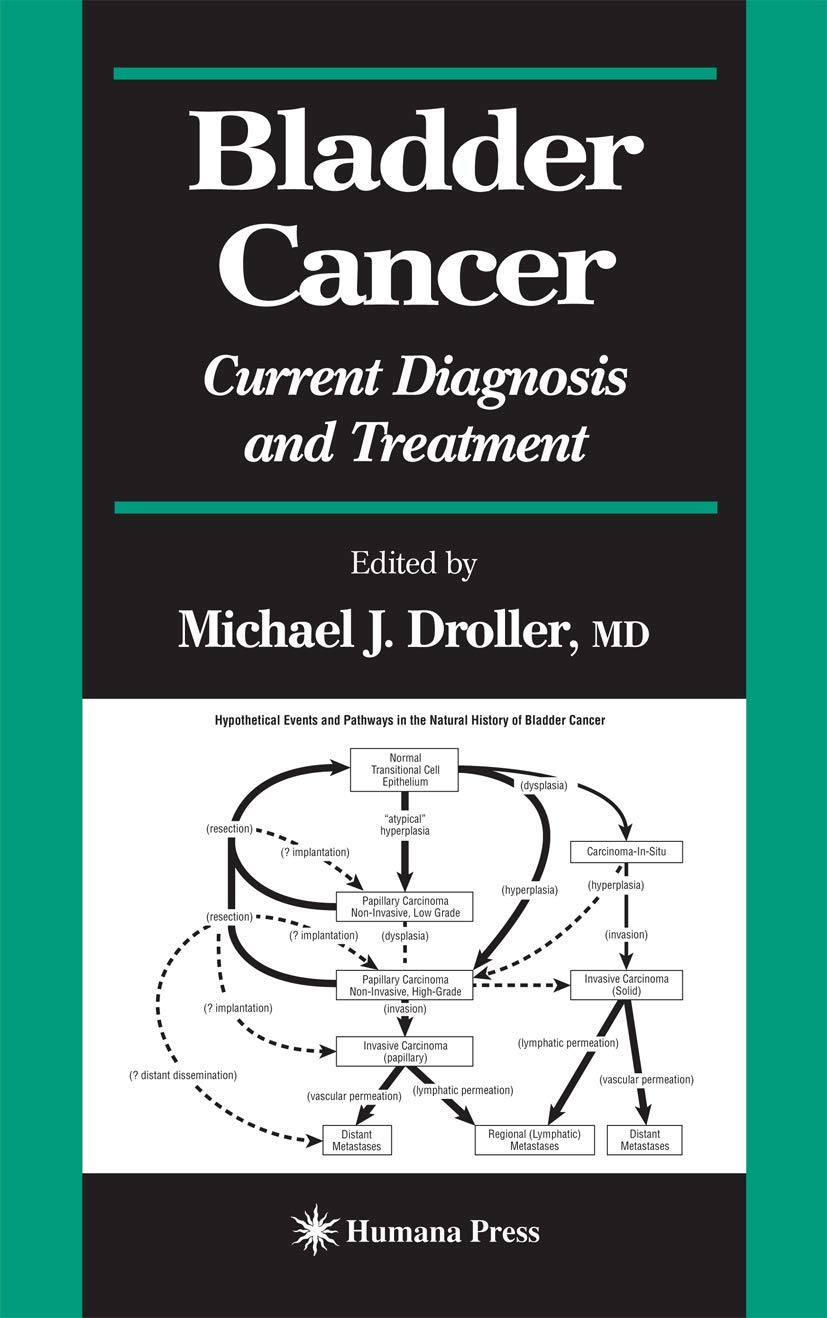 Bladder Cancer Diagnosis and Treatment: Current Clinical Urology