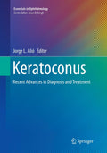 Keratoconus: Recent Advances in Diagnosis and Treatment - Clinical