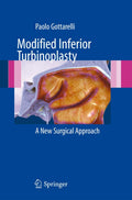 Modified Inferior Turbinoplasty: A New Surgical Approach - Clinical