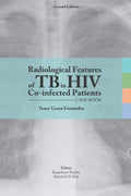 Radiological features of TB in HIV Co-infected Patients - Clinical