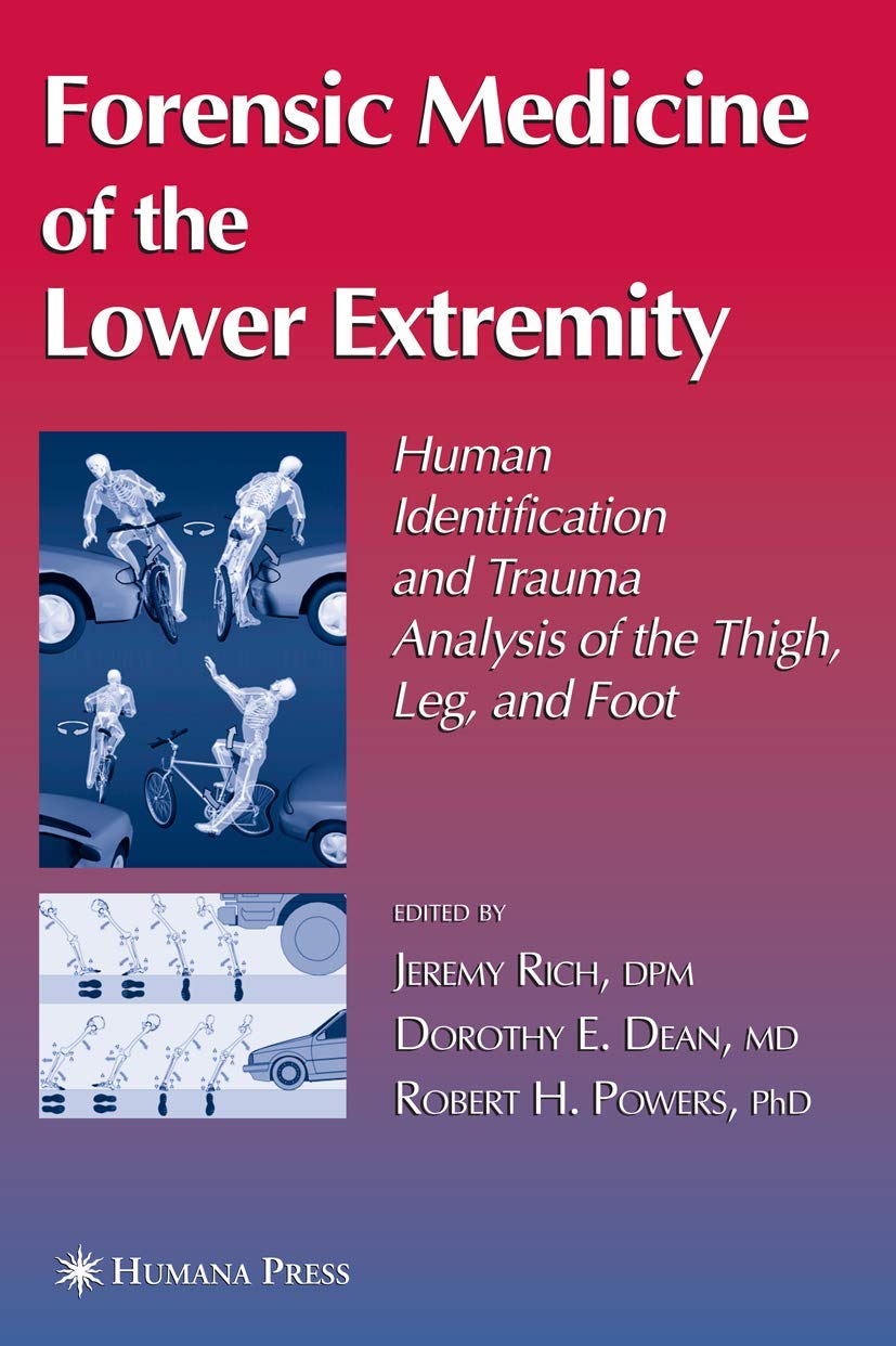 Forensic Medicine of the Lower Extremity: Essential Insights