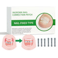 Titanium Alloy Ingrown Toenail Treatment Kit for Home Use