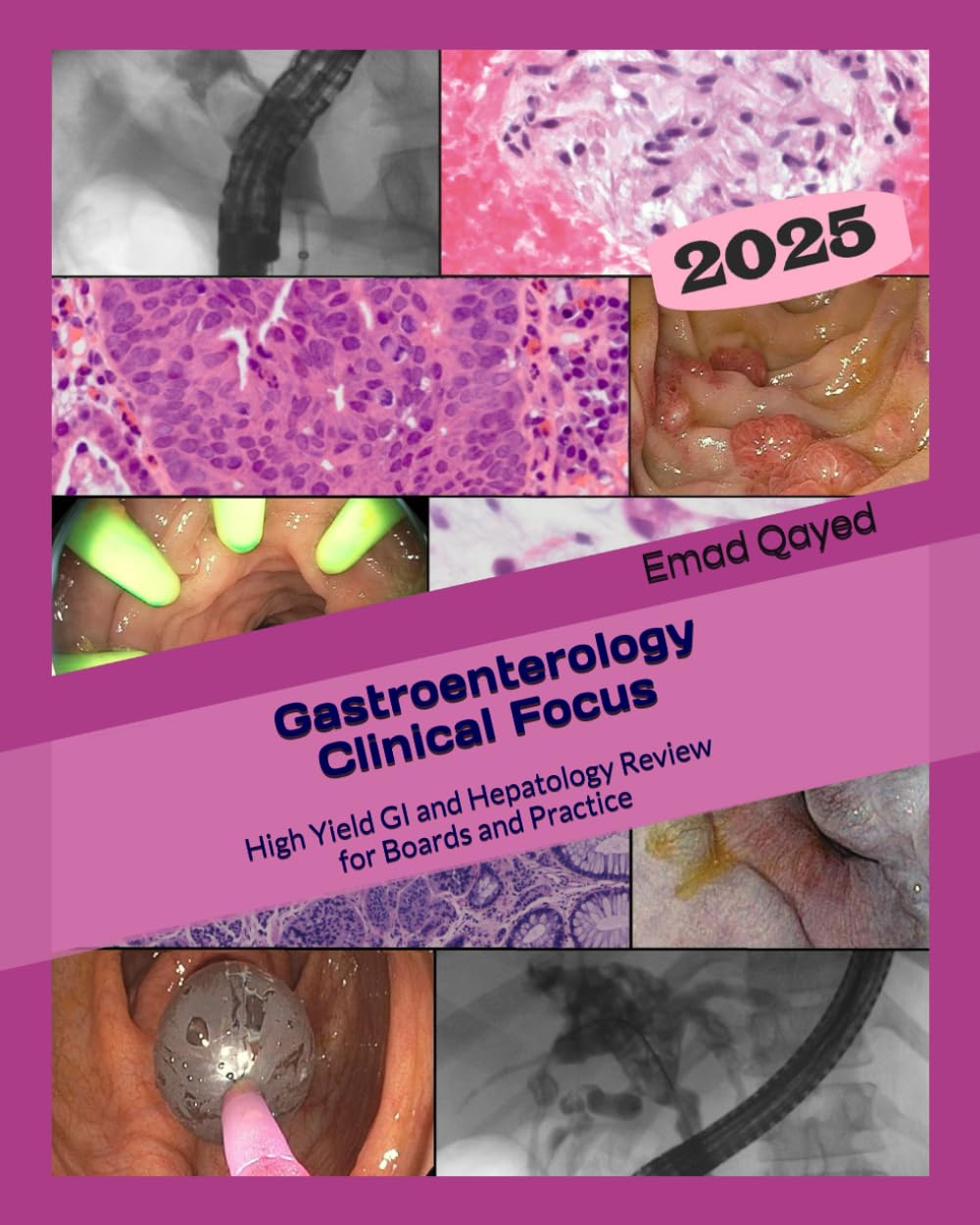 Gastroenterology Clinical Focus: High Yield GI Review for Boards