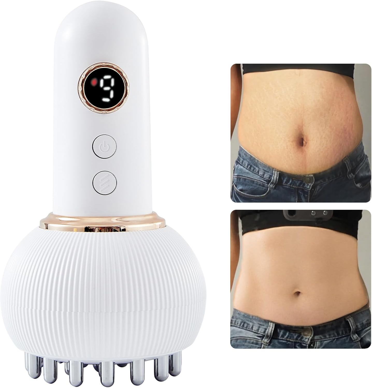 Lymphatic Drainage Massager for Cellulite Reduction & Skin Toning