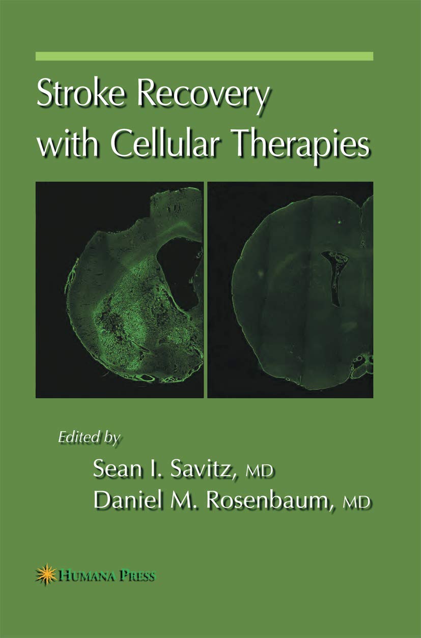 Stroke Recovery with Cellular Therapies: A Comprehensive Guide