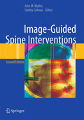 Image-Guided Spine Interventions - Comprehensive Clinical