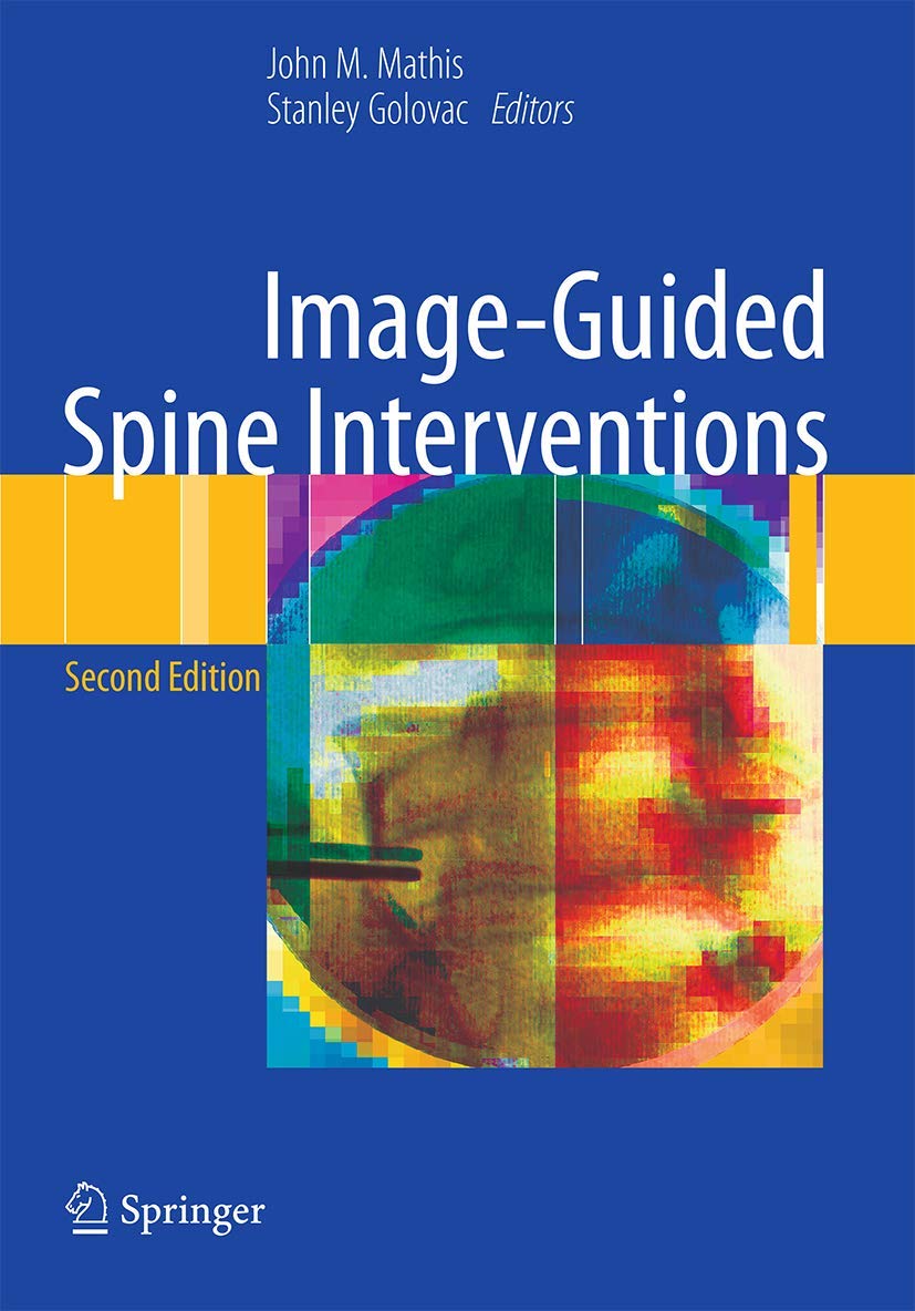 Image-Guided Spine Interventions for Effective Pain Management