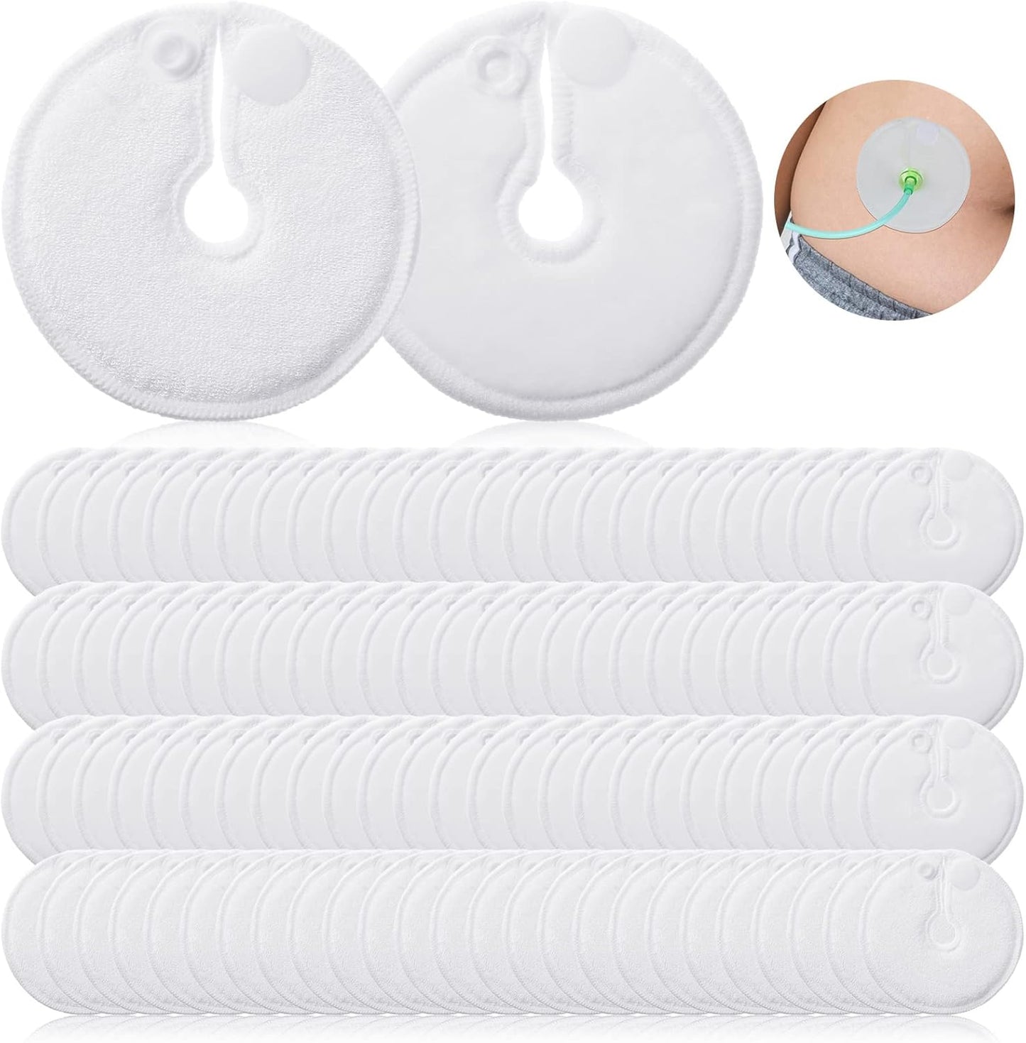 100 Pieces G Tube Pads for Feeding Supplies and Nursing Care