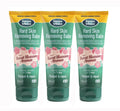 10% Urea Callus Removing Cream - Smoothes and Moisturizes