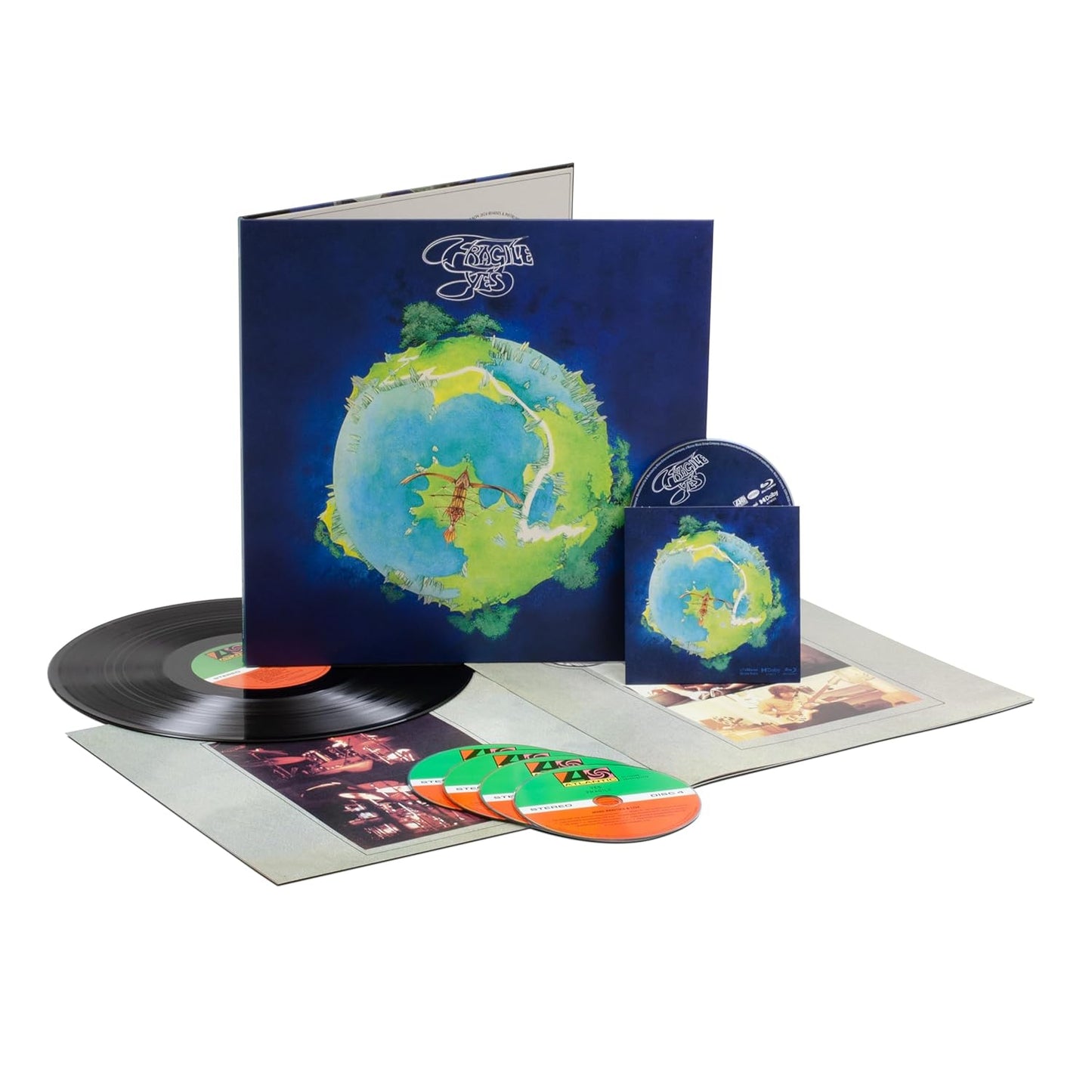 Fragile Super Deluxe Edition: A Must-Have for Music Lovers