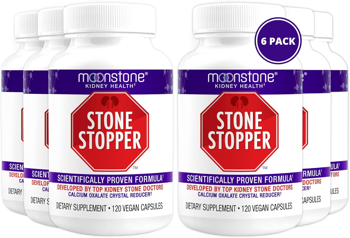 Stone Stopper Capsules for Kidney Stone Prevention and Health