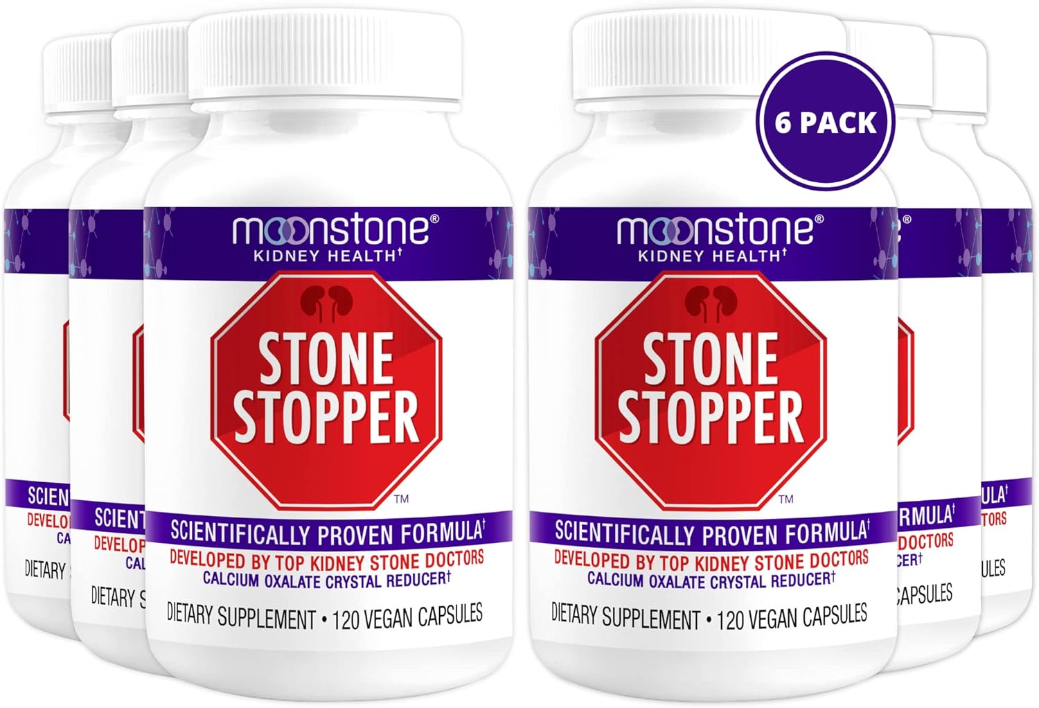 Stone Stopper Capsules for Kidney Stone Prevention and Health