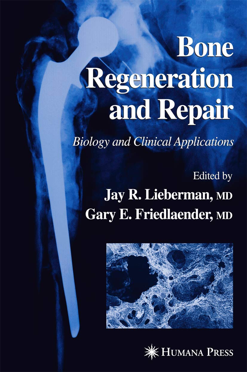 Bone Regeneration and Repair: Biology and Clinical Applications Guide