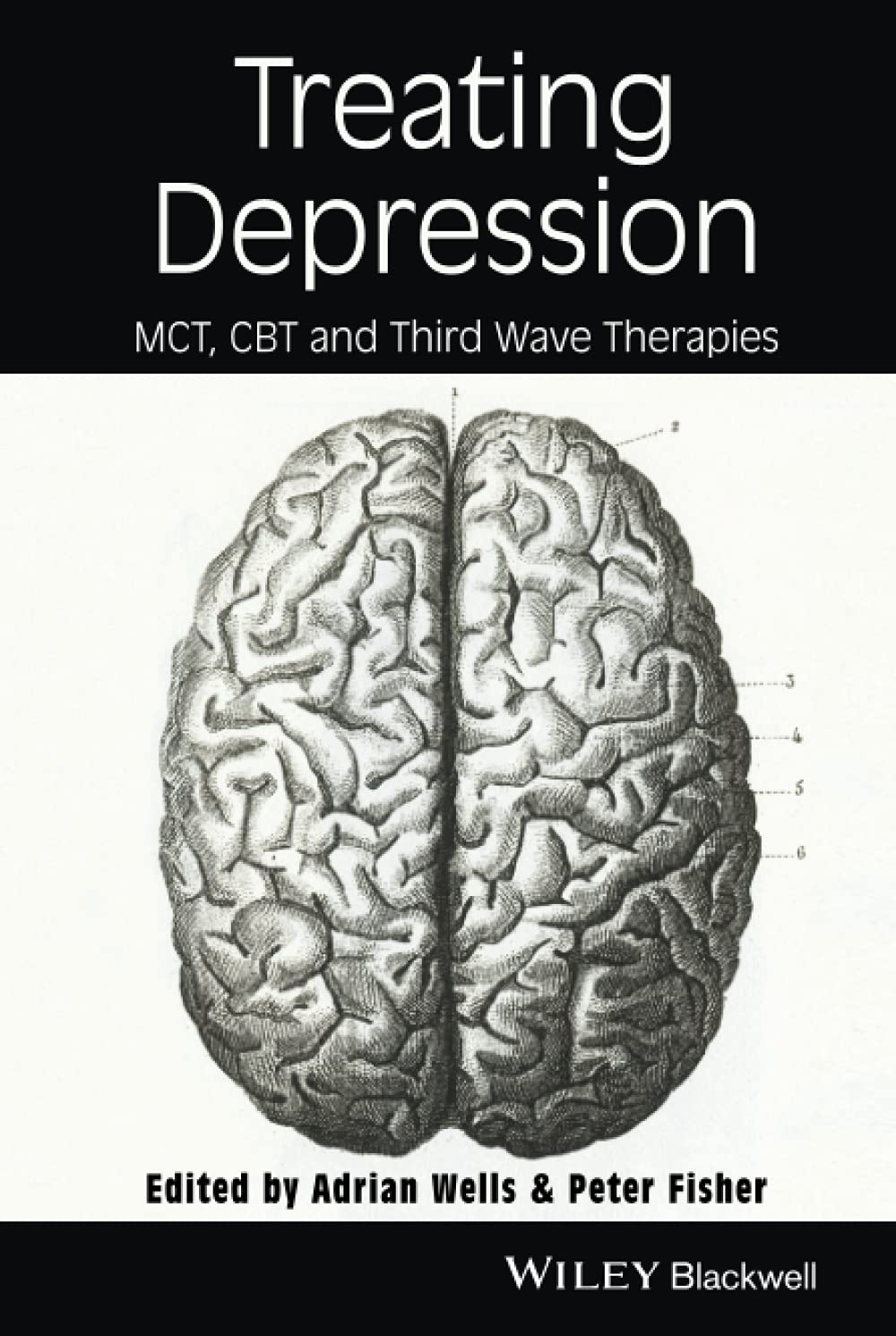 Treating Depression: MCT, CBT, and Third Wave Therapies Guide