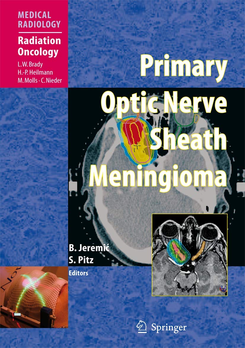 Primary Optic Nerve Sheath Meningioma Insights for Radiation Oncology