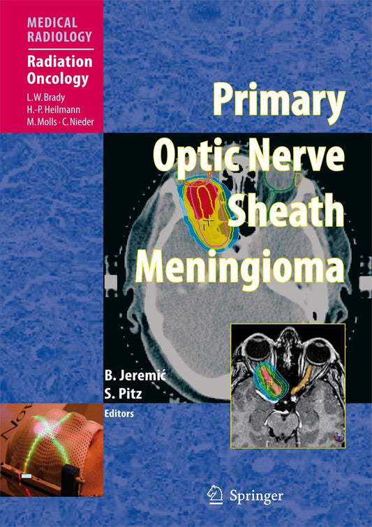 Primary Optic Nerve Sheath Meningioma Insights for Radiation Oncology
