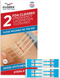 Clozex Emergency Laceration Closures - Painless Alternative