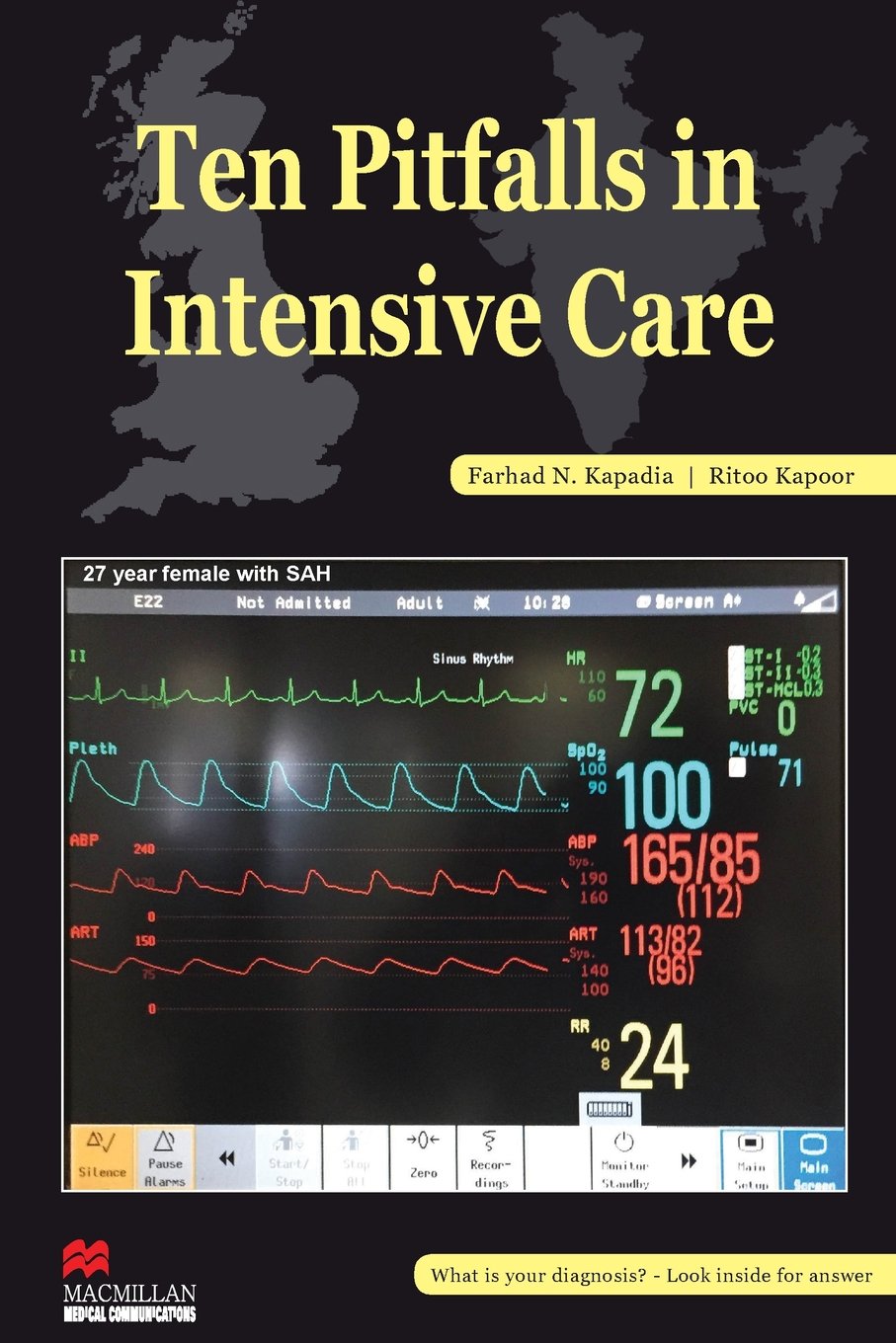 Ten Pitfalls In Intensive Care: Essential Insights for Healthcare