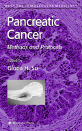 Pancreatic Cancer: Methods and Protocols - Practical Laboratory Guide