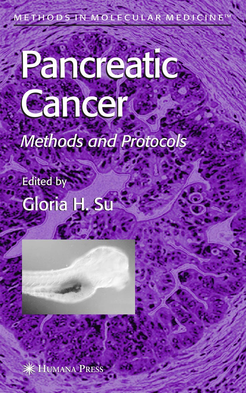 Pancreatic Cancer: Methods and Protocols for Effective Research