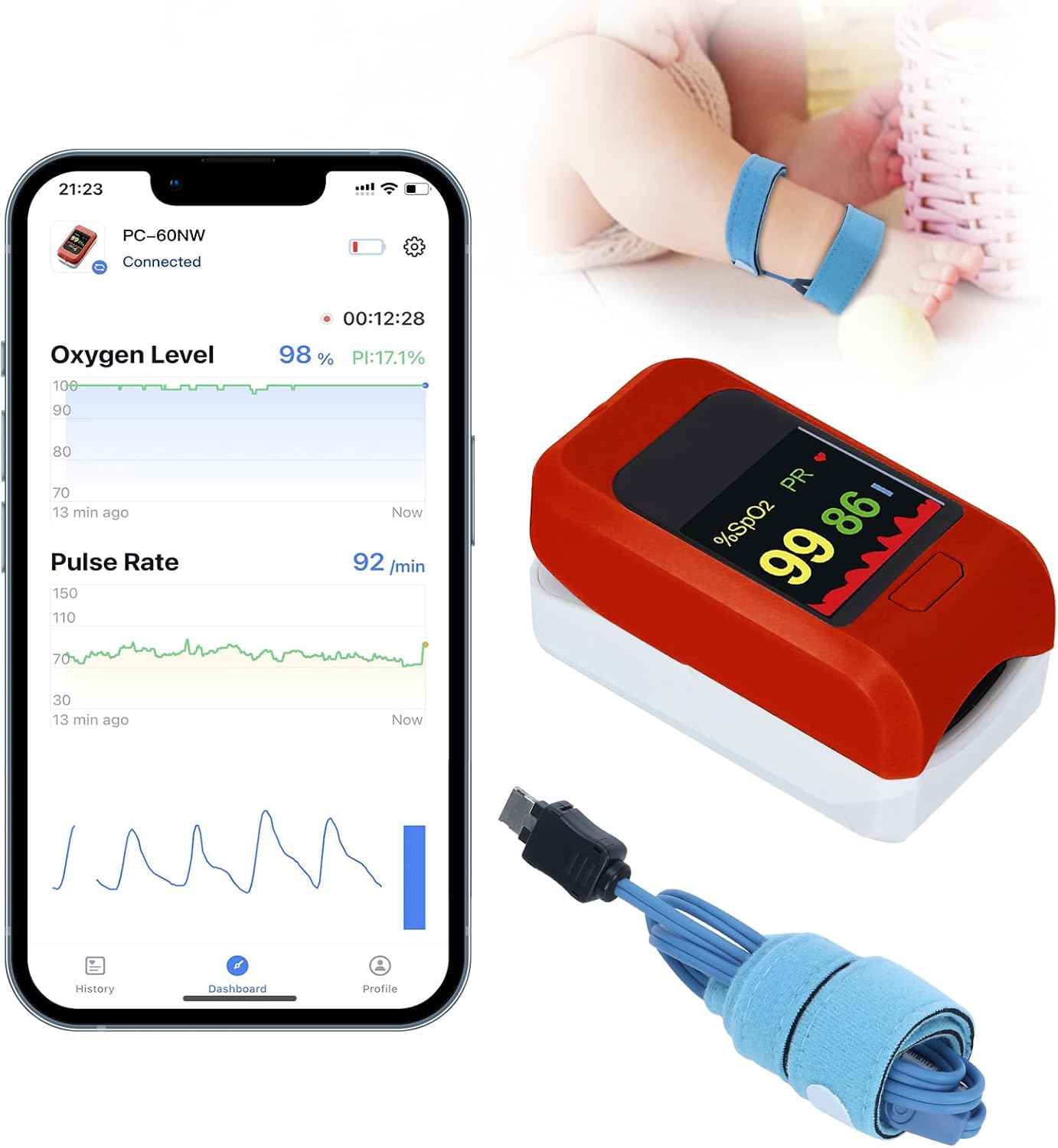 BABY OXYGEN MONITOR: Track Heart Rate & Oxygen Levels