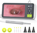 Anykit Digital Otoscope with 4.5 in Screen - Visual Ear Care