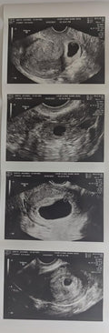 Prank 2D Customized Fake Ultrasound Strip of 4 Photos - Realistic
