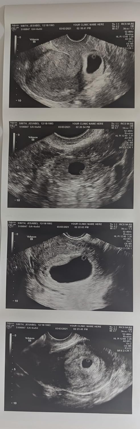 Prank 2D Customized Fake Ultrasound Strip for Hilarious Fun