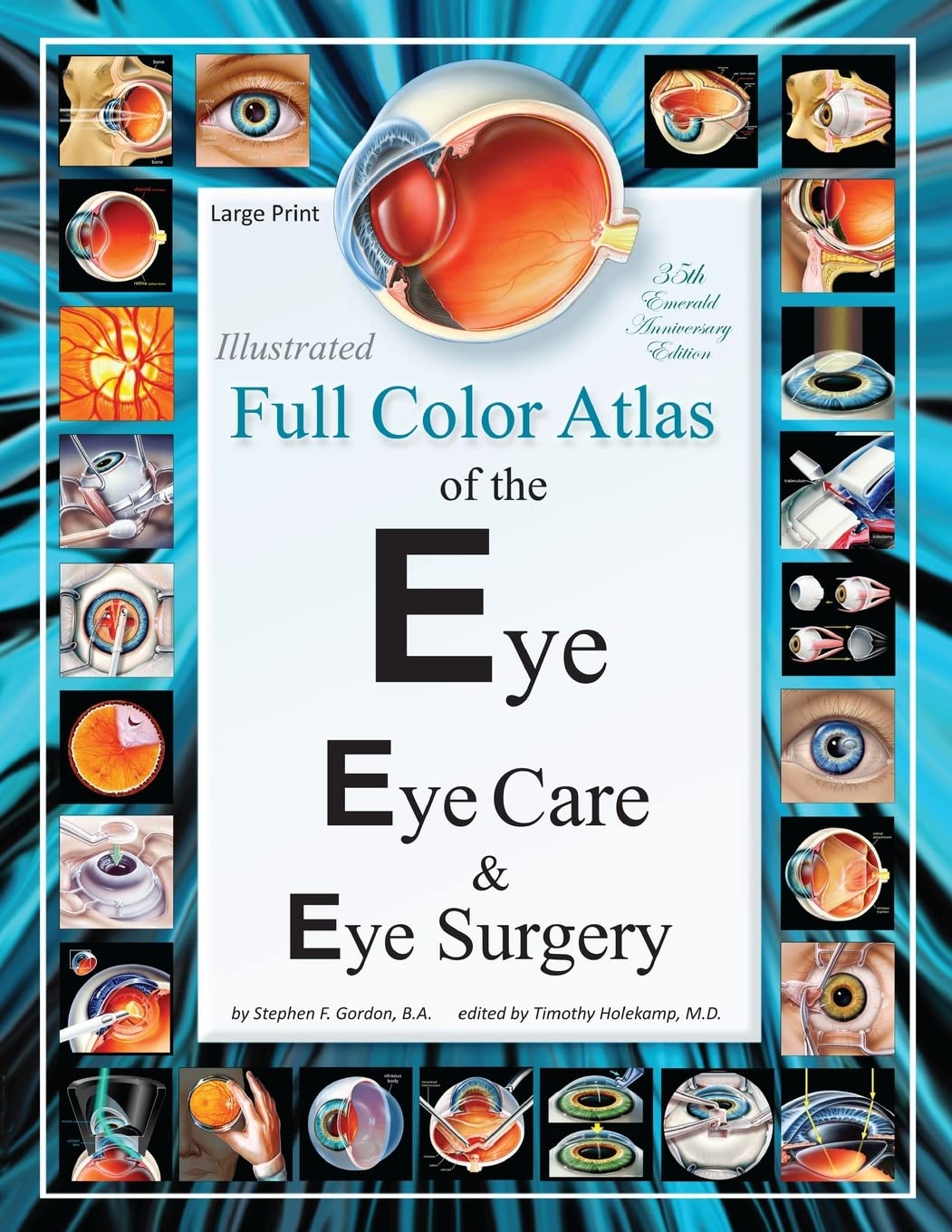 Illustrated Full Color Atlas of the Eye for Eye Care and Surgery