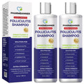 Anti-Fungal Shampoo for Itchy, Dry Scalp - Soothes and Cleanses 2 Pack