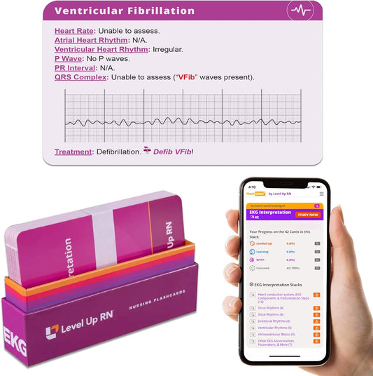 EKG Interpretation Flash Cards by Level Up RN for Nursing