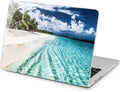 Hard Case Compatible for MacBook Pro 16 14 13 and Air 13 - Tropical