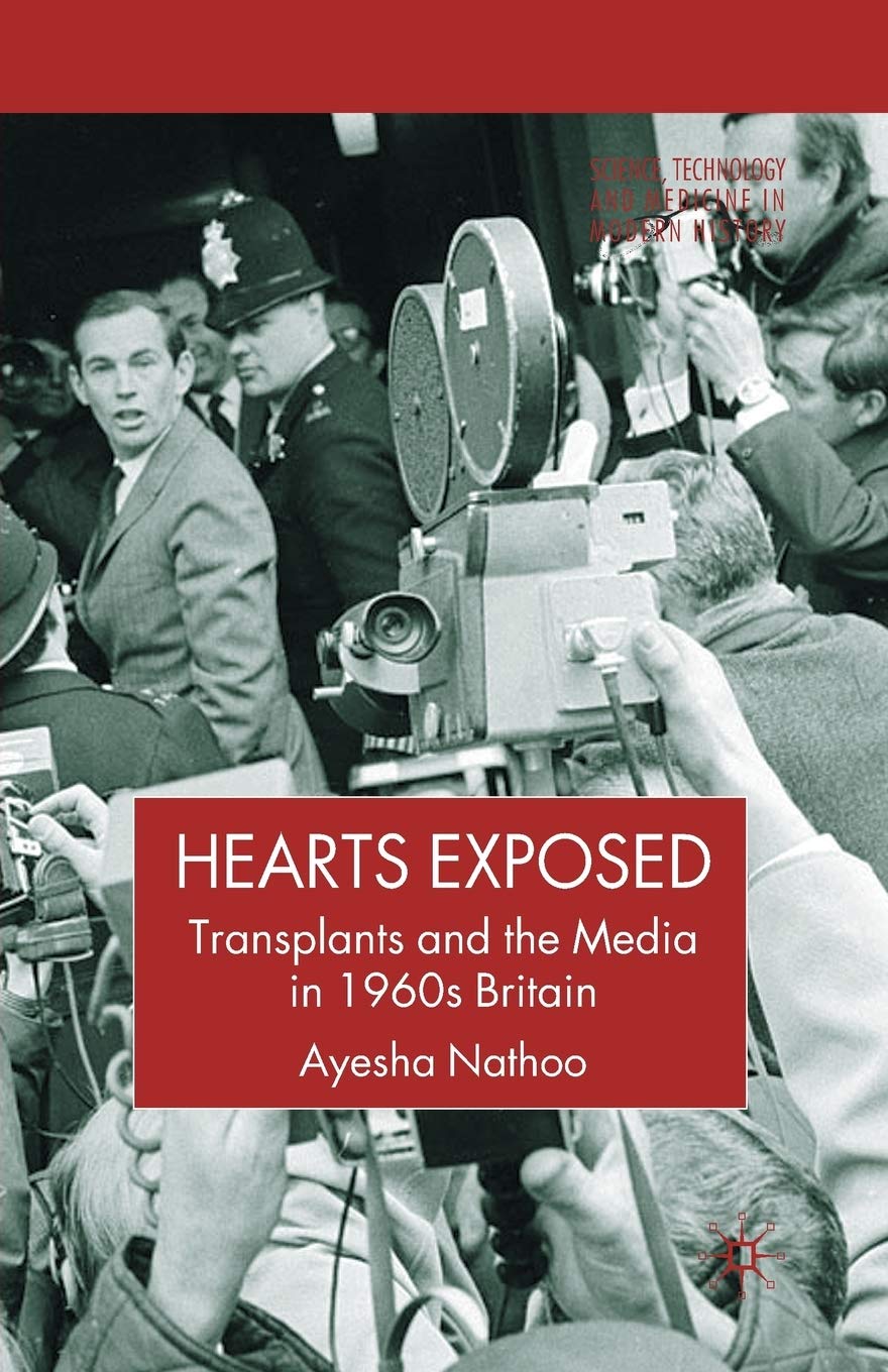 Hearts Exposed: Transplants and the Media in 1960s Britain Review