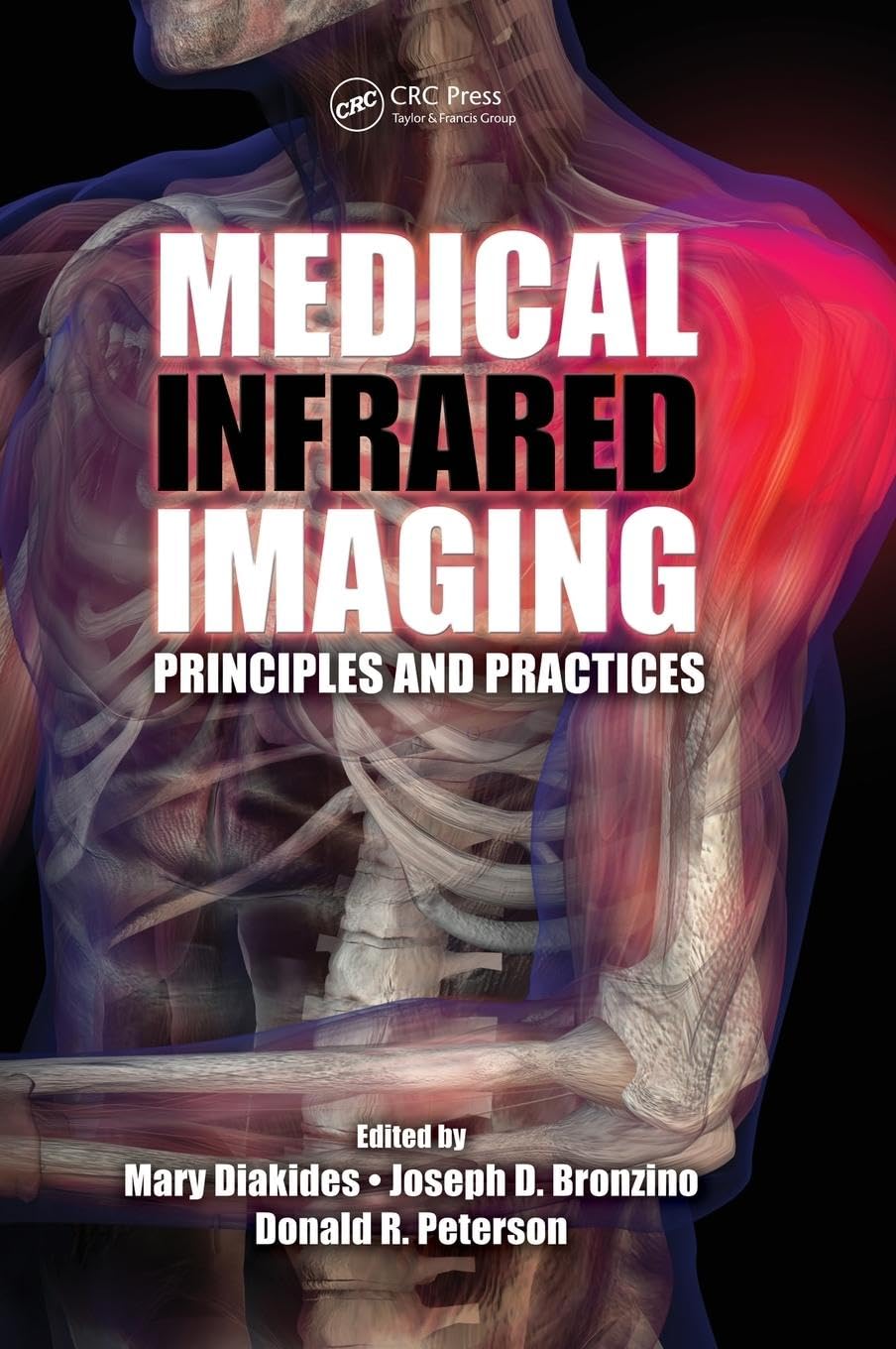 Medical Infrared Imaging: Principles and Practices for Professionals