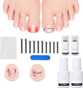 Titanium Alloy Ingrown Toenail Corrector Kit - Quick Relief Curve