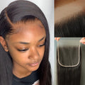 6x6 SKINLIKE Real HD Lace Closure - Ultra-Thin Invisible Hairline