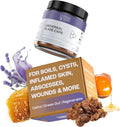 MyMagicHealer Universal Flare Care for Skin Flare-Ups Relief