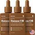 Keyoma Batana Oil for Hair Growth - 100% Organic 90 mL