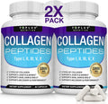 Toplux Multi Collagen Peptides Pills for Skin, Hair, and Joints